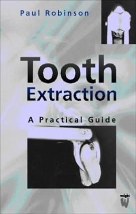 Tooth Extraction A Practical Guide 2000 By Robinson