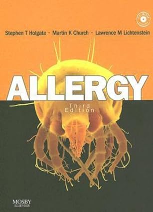Allergy 3rd Edition With Cd-Rom 2007 By Holgate