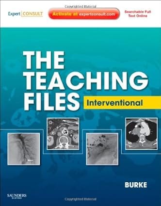 The Teaching Files Interventional Expert Consult - Online And Print 2009 By Burke K