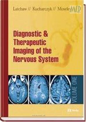 Imaging Of The Nervous System Diagnostic And Therapeutic Applications 2 Vol. Set 2005 By Latchaw R E