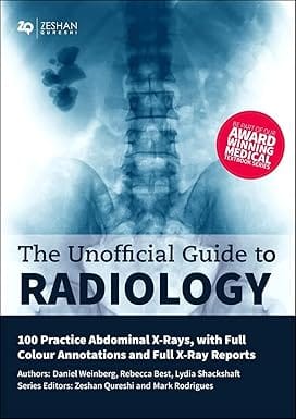 The Unofficial Guide To Radiology 100 Practice Abdominal X Rays With Full Colour Annotations And Full X Ray Reports 2020 By Zeshan Qureshi
