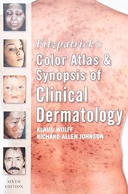 Fitzpatricks Color Atlas And Synopsis Of Clinical Dermatology 6th Edition 2009 By Wolff K
