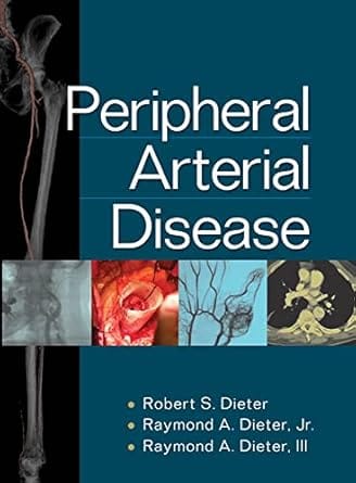 Peripheral Arterial Disease 2009 By Dieter R S