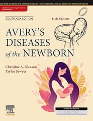 Avery?s Diseases of the Newborn 11th South Asia Edition 2024 By Christine A Gleason