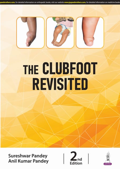 The Clubfoot Revisited 2nd Edition 2025 By Sureshwar Pandey