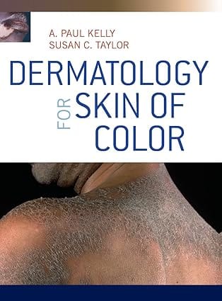 Dermatology For Skin Of Color 2009 By Kelly A P