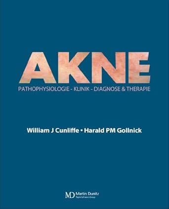 Akne Diagnose Und Therapie 2004 By Cunliffe W J
