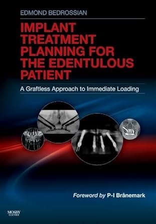 Implant Treatment Planning For The Edentulous Patient 2011 By Bedrossian E