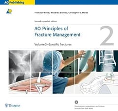Ao Principles Of Fracture Managment 2 Vol Set 2nd Edition 2007 By Ruedi T P