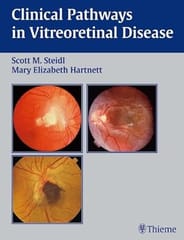 Clinical Pathways In Vitreoretinal Disease 2006 By Steidl S M