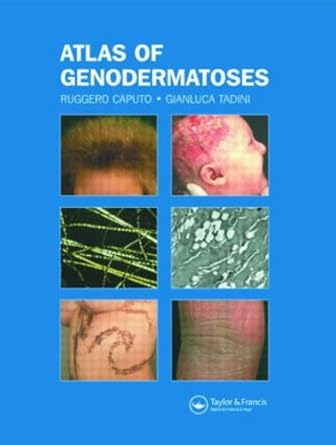 Atlas Of Genodermatoses 2005 By Caputo R