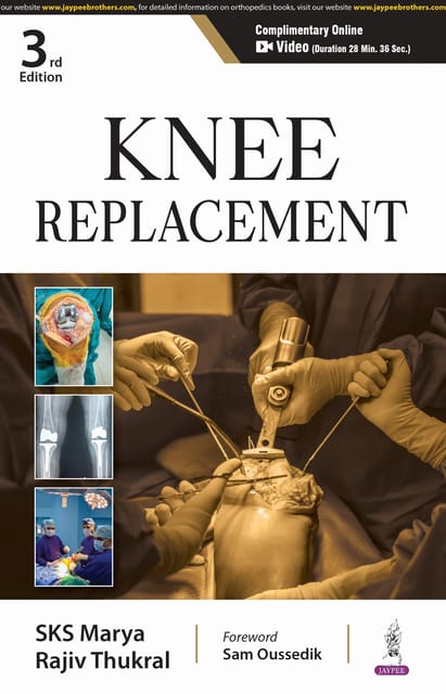 Knee Replacement 3rd Edition 2025 By SKS Marya & Rajiv Thukral