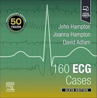 160 Ecg Cases 6th Edition 2025 By Hampton J