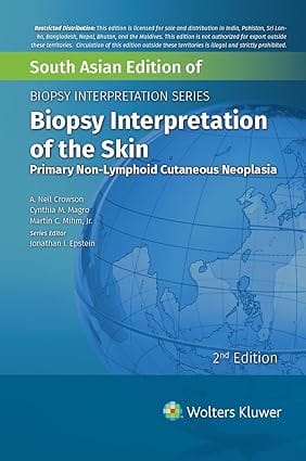 Biopsy Interpretation Series Biopsy Interpretation Of The Skin Primary Non Lymphoid Cutaneous Neoplasia 2nd Edition South Asia Edition 2025 By Crowson A N