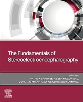 The Fundamentals Of Stereoelectroencephalography 2024 By Chauvel P