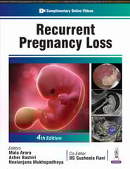 Recurrent Pregnancy Loss 4th Edition 2025 By Mala Arora