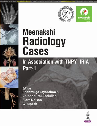 Meenakshi Radiology Cases : In Association With Tnpy-Iria Part-1 1st Edition 2025 By Shanmuga Jayanthan S