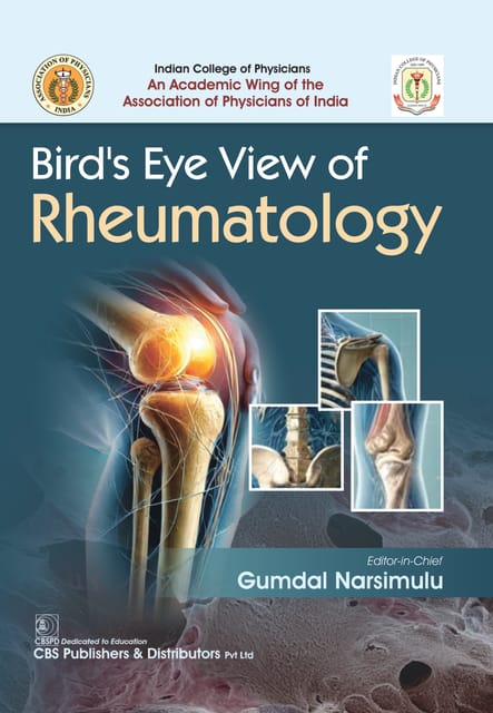 Birds Eye View Of Rheumatology  2025  By Gumdal Narsimulu