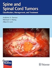 Spine and Spinal Cord Tumors Classification, Management, and Treatment 1st Edition 2025 By Fanous