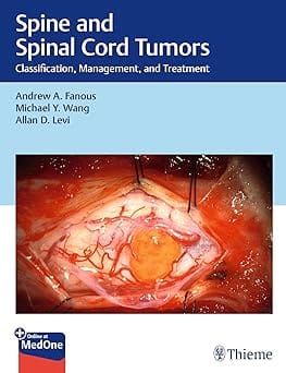 Spine and Spinal Cord Tumors Classification, Management, and Treatment 1st Edition 2025 By Fanous