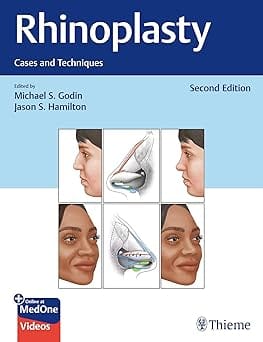 Rhinoplasty 2nd Edition 2025 By Godin