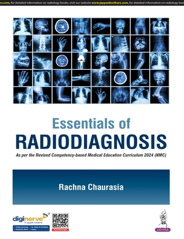 Essentials Of Radiodiagnosis 1st Edition 2025 By Rachna Chaurasia