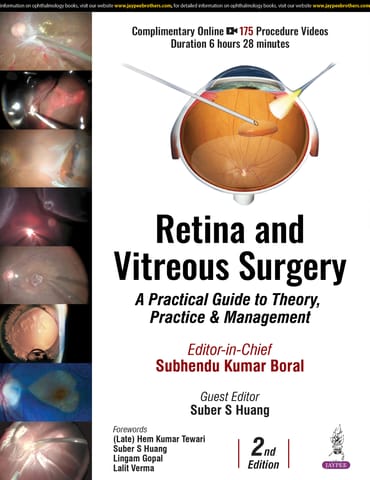 Retina And Vitreous Surgery : A Practical Guide To Theory, Practice & Management 2nd Edition 2025 By Subhendu Kumar Boral