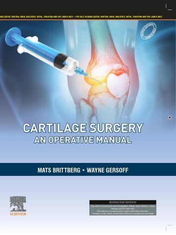 Cartilage Surgery An Operative Manual  2025 By Brittberg M