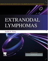 Extranodal Lymphomas  2025 By Ferry J A