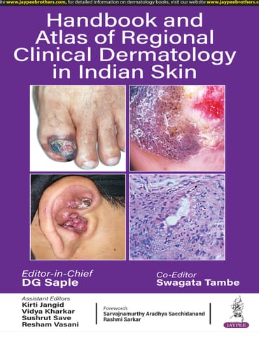 Handbook And Atlas Of Regional Clinical Dermatology In Indian Skin 1st Edition 2025 By Dg Saple