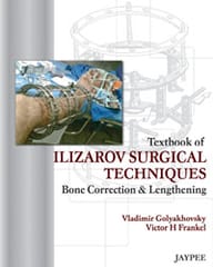 Textbook Of Ilizarov Surgical Techniques Bone Correction & Lengthening 1st Reprint Edition 2025 By Vladimir Goyakhovsky