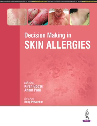 Decision Making In Skin Allergies 1st Edition 2025 By Kiran Godse