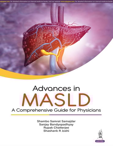 Advances In Masld : A Comprehensive Guide For Physicians 1st Edition 2025 By Shambo Samrat Samajdar