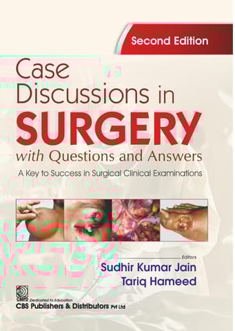 Case Discussions in Surgery with Questions and Answers A Key to Success in Surgical Clinical Examinations 2nd Edition 2026 By udhir Kumar Jain & Tariq Hameed