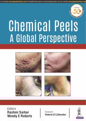 Chemical Peels: A Global Perspective 1st Reprint Edition 2025 By Rashmi Sarkar