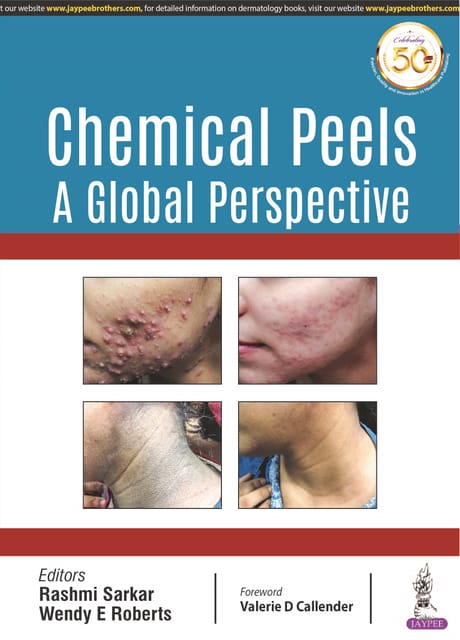 Chemical Peels: A Global Perspective 1st Reprint Edition 2025 By Rashmi Sarkar