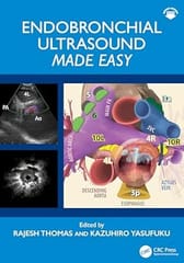 Endobronchial Ultrasound Made Easy 2026 By Thomas R