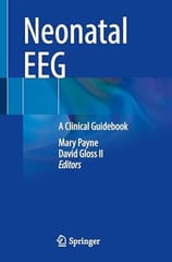 Neonatal Eeg A Clinical Guidebook 2025 By Payne M