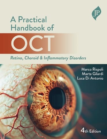 Practical Handbook Of Oct Retina, Choroid & Inflammatory Disorders 4th Edition 2026 By Marco Rispoli