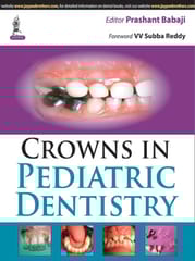 Crowns In Pediatric Dentistry 1st Reprint Edition 2025 By Prashant Babaji