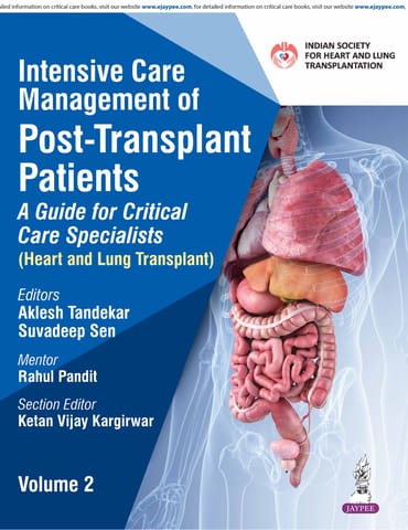Intensive Care Management Of Post-Transplant Patients: A Guide For Critical Care Specialists Vol.2, 1st Edition 2026 By Aklesh Tandekar