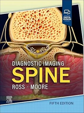 Diagnostic Imaging: Spine 5th Edition 2025 By Ross