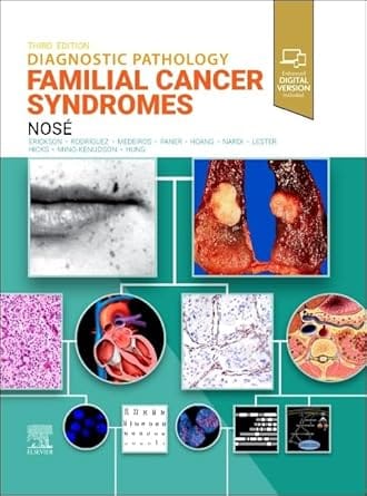 Diagnostic Pathology: Familial Cancer Syndromes 3rd Edition 2025 By Nose