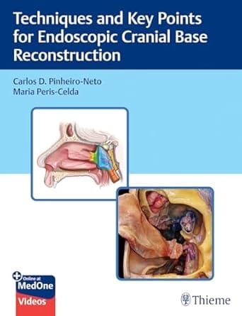 Techniques and Key Points for Endoscopic Cranial Base Reconstruction 1st Edition 2022 By Pinheiro-Neto