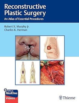 Reconstructive Plastic Surgery : An Atlas of Essential Procedures 1st Edition 2022 By Murthy