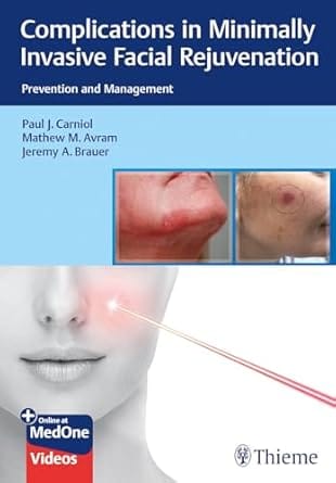 Complications in Minimally Invasive Facial Rejuvenation 1st Edition 2021 By Carniol
