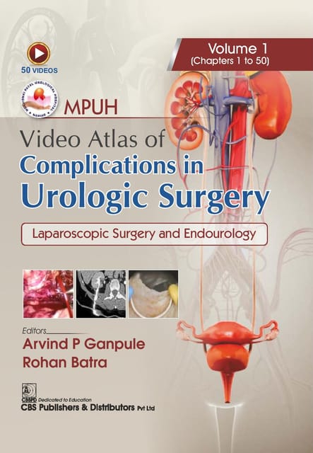 MPUH Video Atlas of Complications in Urologic Surgery, Volume 1 Laparoscopic Surgery and Endourology 1st Edition 2025 By Arvind P Ganpule