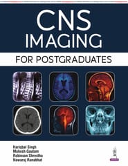 CNS Imaging For Postgraduates 1st Edition 2026 By Hariqbal Singh