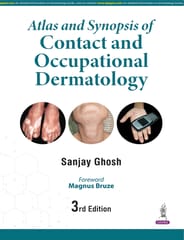 Atlas And Synopsis Of Contact And Occupational Dermatology 3rd Edition 2026 By Sanjay Ghosh