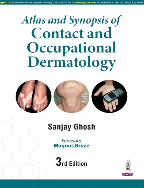 Atlas And Synopsis Of Contact And Occupational Dermatology 3rd Edition 2026 By Sanjay Ghosh